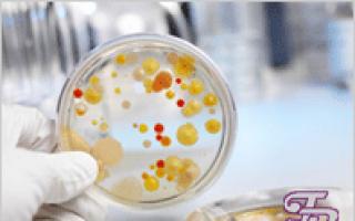 Восстановление микрофлоры кишечника: помощь «хорошим» бактериям в организме
